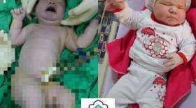 تولد نوزاد ۶ کیلویی در اردکان یزد