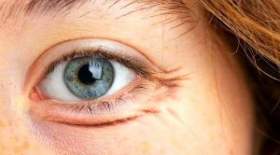 جلوگیری از چروک شدن دور چشم با چند روش ساده