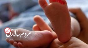 تولد نوزاد منحصربه‌فرد در مشهد