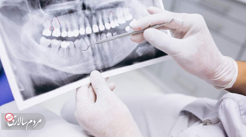 دردناک ولی واقعی؛ کشیدن دندان به خاطر نداشتن هزینه درمان